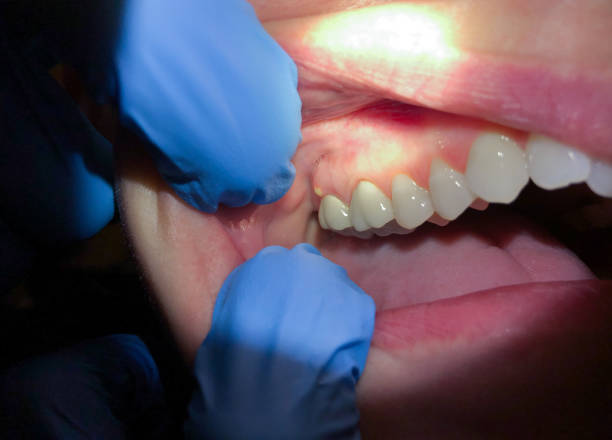 Best Emergency Dental Services for Seniors in Midtown, TN